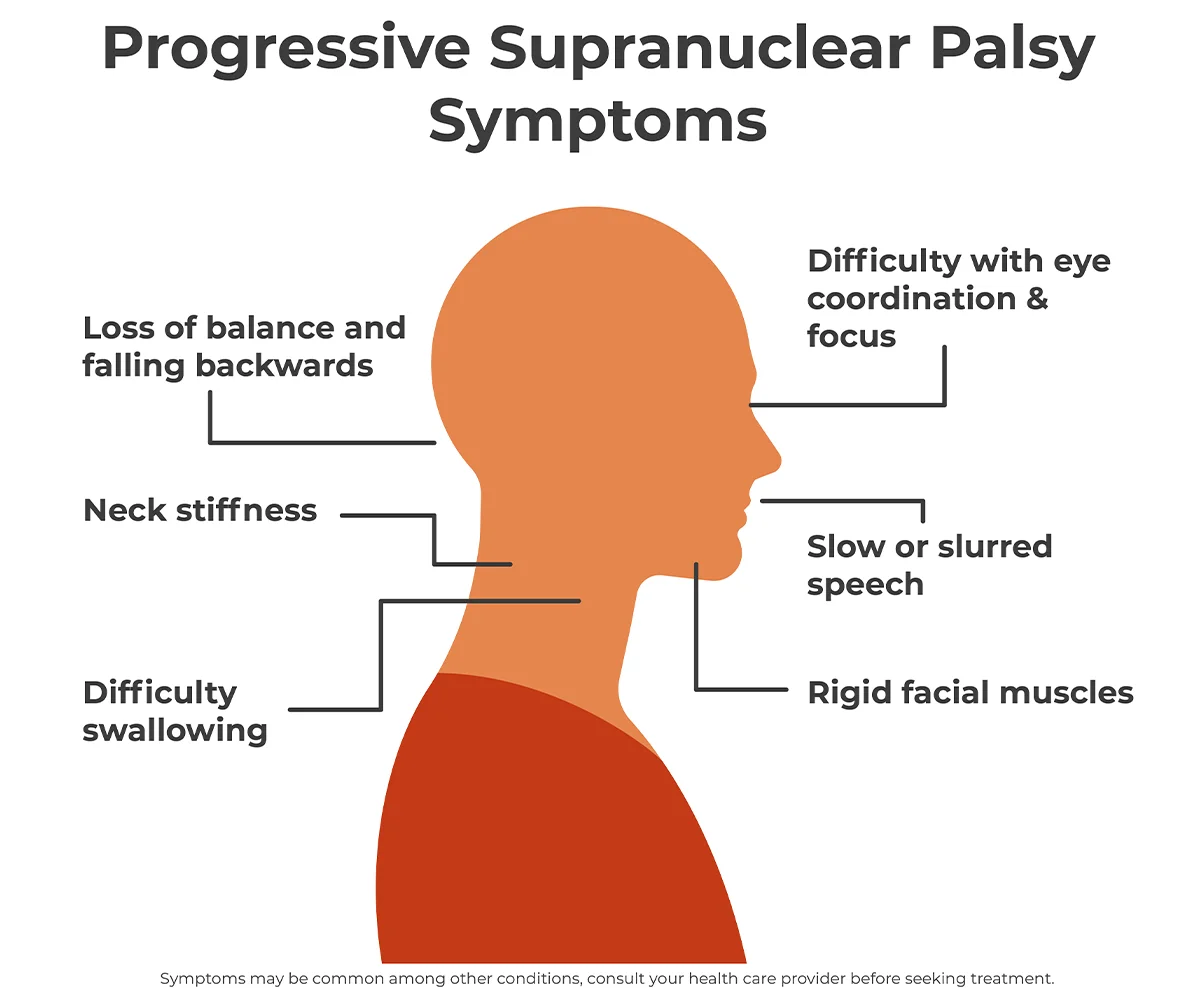 The image shows symptoms of progressive supranuclear palsy (PSP) in the neck and head of the body.