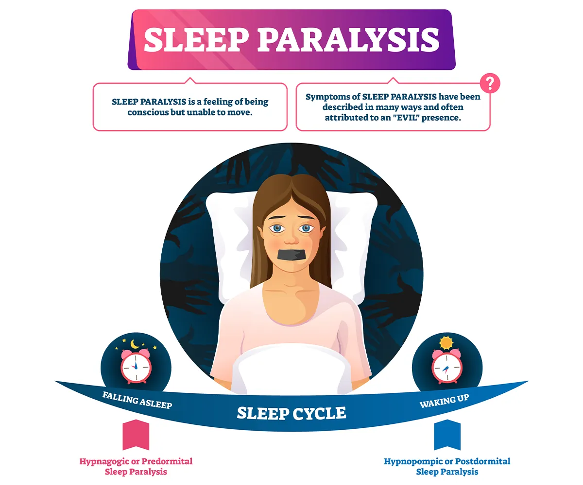 Illustration of sleep paralysis shows a person lying in bed, unable to move, with a fearful expression. The image depicts the sleep cycle phases: falling asleep  and waking up.